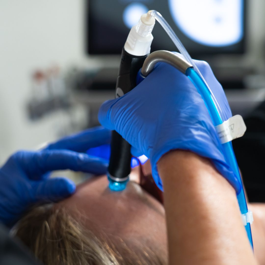 hydrafacial