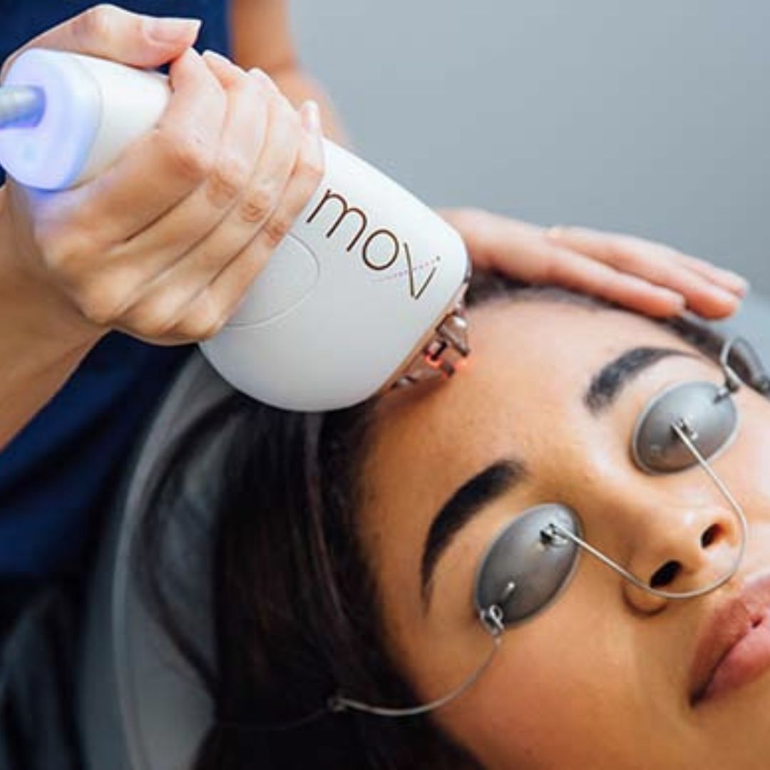 moxi laser treatment (1)