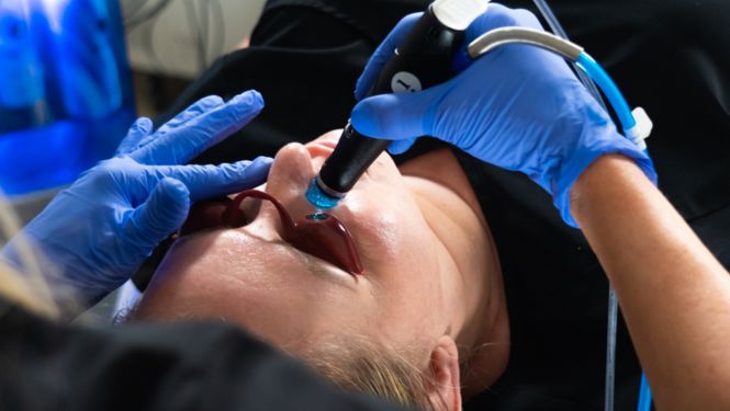 HydraFacial Patient